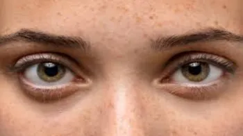 eyes